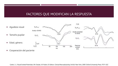 Potenciales Evocados Visuales Pptx