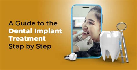 A Guide To The Dental Implant Treatment Step By Step