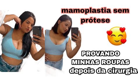 Minhas roupas depois da cirurgia mamoplastia sem prótese YouTube