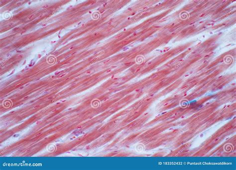 Histologia Do M Sculo Card Aco Humano Sob Vis O Microsc Pica Para