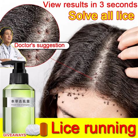 lice remover shampoo Licealiz Head Lice Treatment Shampoo treatment ...