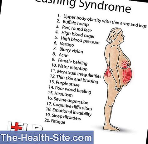 Cushing'S Disease: Causes, Symptoms, Therapy 💊 Scientific-Practical ...