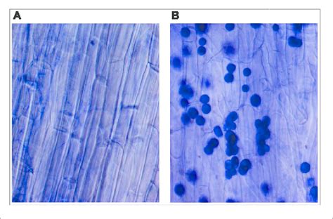 Trypan Blue Staining Of Maize Plant Roots To Show The Colonization Of