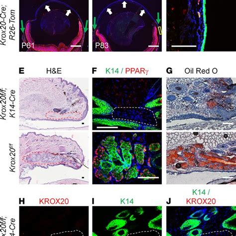 Krox Lineage Tracing In The Meibomian Gland A Lineage Tracing Of