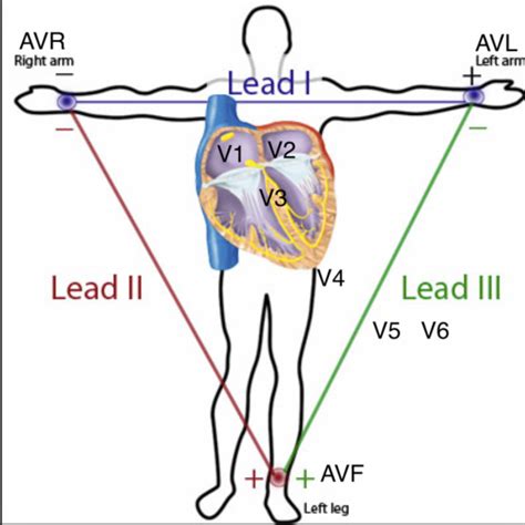 12 Lead Ekg Interpretation Flashcards Quizlet