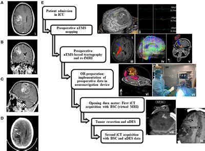 Frontiers Case Report Multimodal Functional And Structural