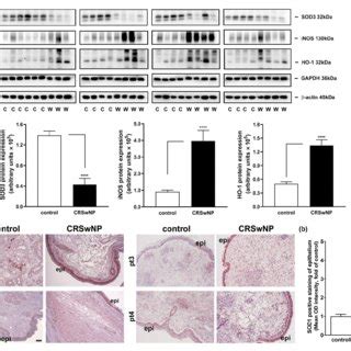 Western Blot And Ihc Analysis Of Protein Expression Levels In The