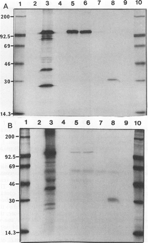 A Immunoprecipitation Of 35s Methionine Metabolically Labeled