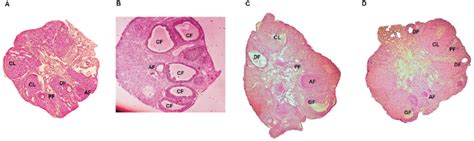 Cross Sections Of Ovaries Of Rats Of PCOS Control Metformin And