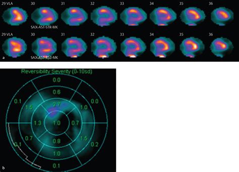 Part Cardiac Radiology Key