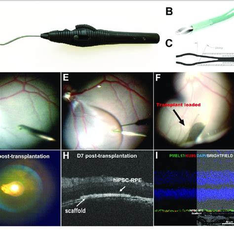 Surgical Delivery Instrument And Outcome Of Subretinal Delivery Of