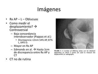 Fractura Epicondilo Medial En Ni Os Ppt