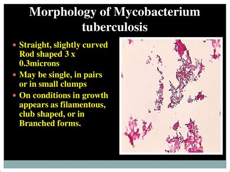 Structure Of Mycobacterium Tuberculosis