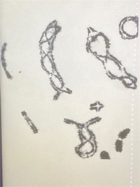 Solved The Image Above Depicts Chromosomes In What Phase