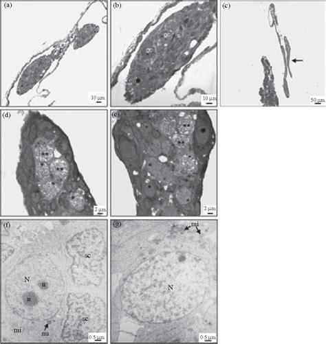 Figure From Gonadal Morphogenesis And Sex Differentiation In The