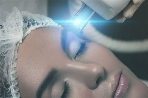 Rejuvenescimento A Laser De Co Entenda Como Funciona Cl Nica De Pele