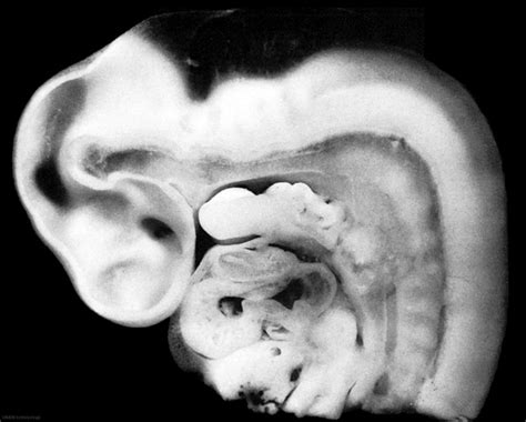 Gastrointestinal Tract Oesophagus Development Embryology