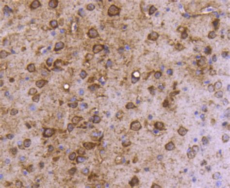 Map Lc A Rabbit Mab Sab Signalway Antibody