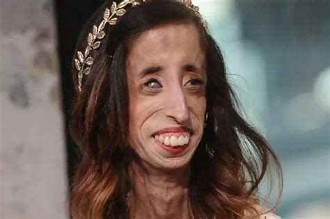 Woman Branded World S Ugliest Reveals How She Fought Back Against Cruel Bullies World News