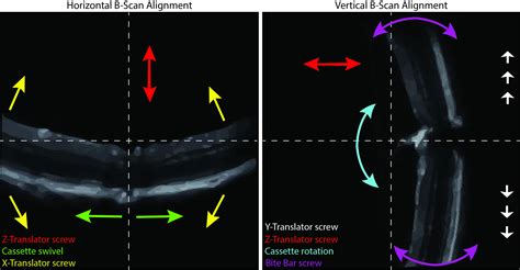 Optical Coherence Tomography Imaging Mouse Retinal Ganglion Cells In Vivo