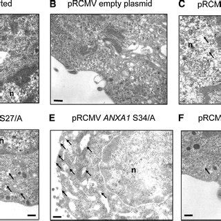 Electron Microscopic Analysis Of Anxa Subcellular Localization In