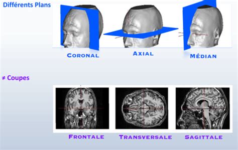 Neuropsychologie Neuroanatomie Cartes Quizlet