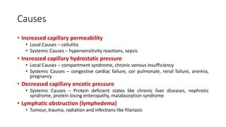 Approach to Pedal Edema (for undergraduates) | PPT