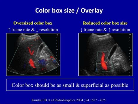 Principles Of Doppler Ultrasound