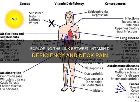 Exploring The Link Between Vitamin D Deficiency And Neck Pain Medshun