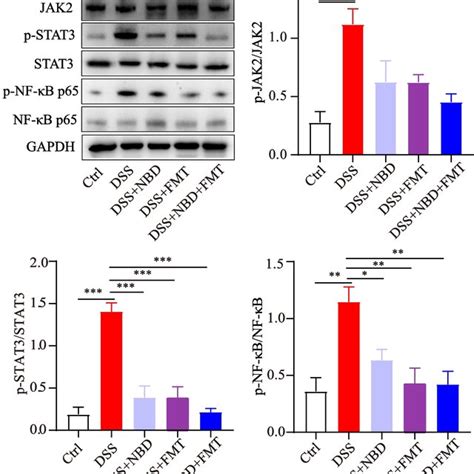 NBD combined with FMT suppressed the activity of the JAK2 STAT3 NF κB