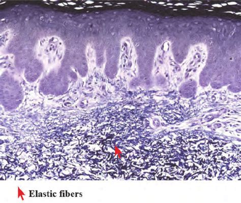 Magnetic Resonance Imaging Of The Abdomen Before Left And Months