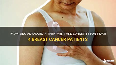 Promising Advances In Treatment And Longevity For Stage 4 Breast Cancer Patients | MedShun