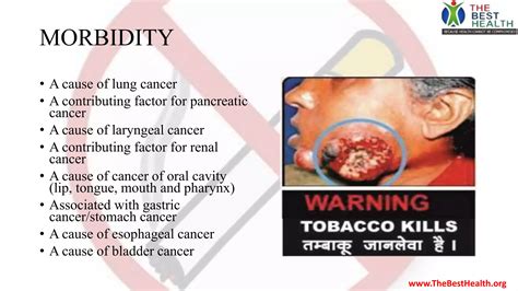 Tobacco Awareness Ppt Smoking Ppt Ppt