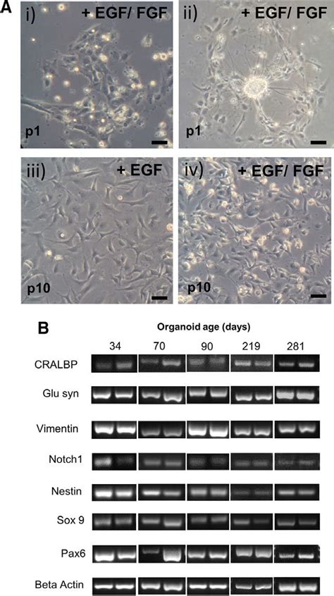 Morphology And Expression Profile Of Müller Glia Isolated From Induced