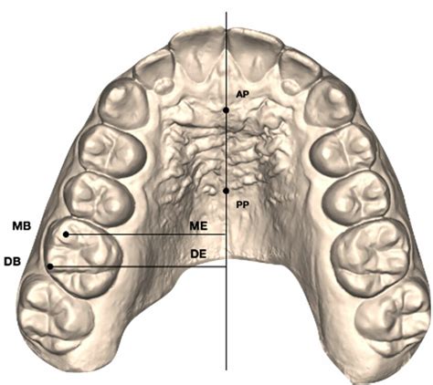 A Linear Measurements Of The Expansion Movements Me De Of The Download Scientific Diagram