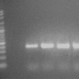 Ethidium Bromide Stained Agarose Gel Electrophoresis Containing The