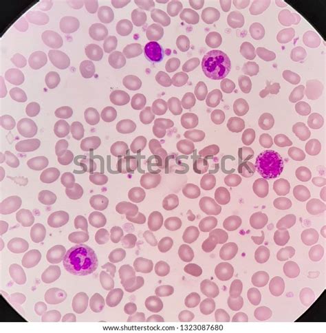 Human Blood Smear Hypochromic Red Blood Stock Photo (Edit Now) 1323087680