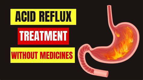 How To Treat Acid Reflux Without Medicines Gerd Treatment Heartburn