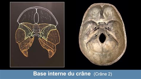 Anatomie de la base interne du crâne Ostéologie du crâne 2 YouTube