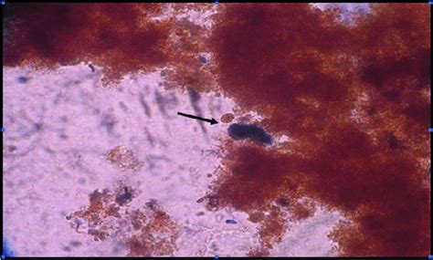 Lugols Iodine Stained Stools Smear Showing Giardia Lamblia Cyst X400 Download Scientific