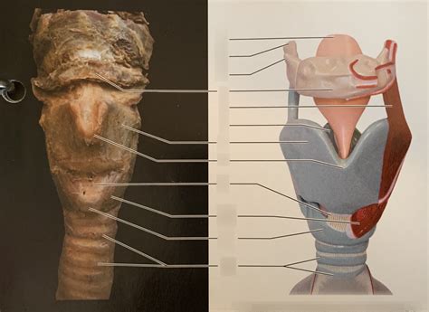 Larynx Anterior View Diagram Quizlet