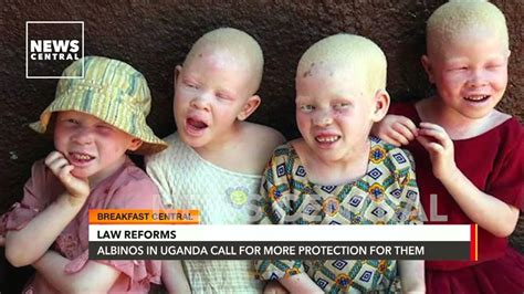 Law Reforms Albinos In Uganda Call For More Protection For Them Youtube