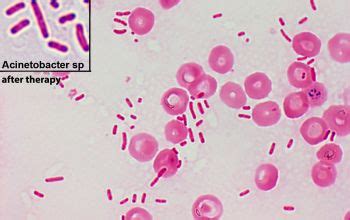 Acinetobacter Baumannii Gram