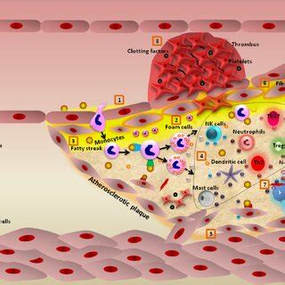 Mechanism Of LDL Oxidation And Monocyte Invasion 1 LDL MM LDL And