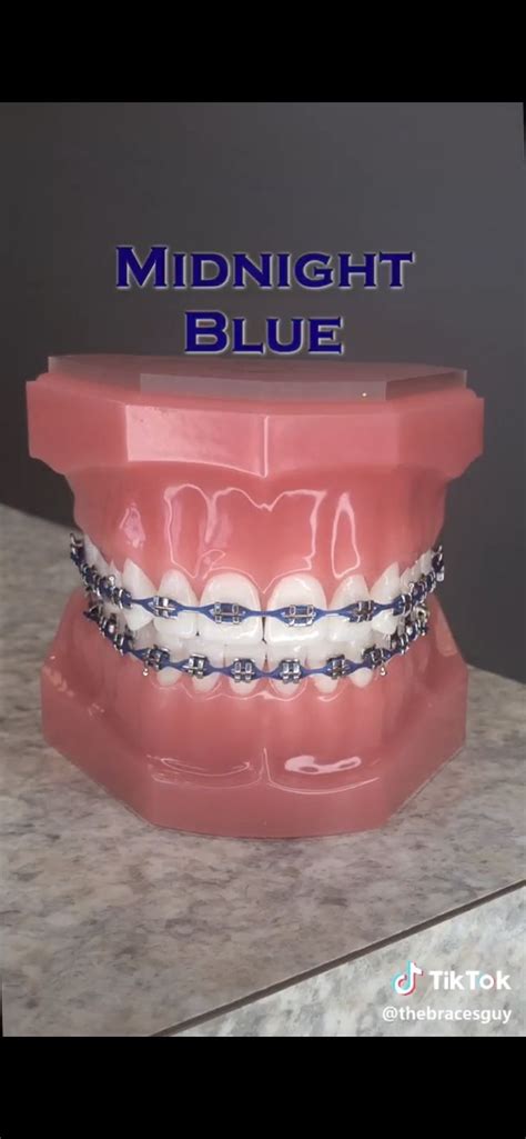 Pin by Blanca Castro on Braces | Braces colors, Braces teeth colors ...