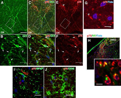 Oligodendrocytes But Not Astrocytes Or Microglia Express P75 After