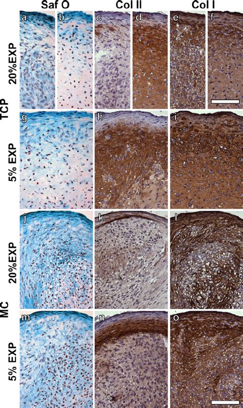 Histology And Immuno Histochemistry On Pellet Cultures From Human