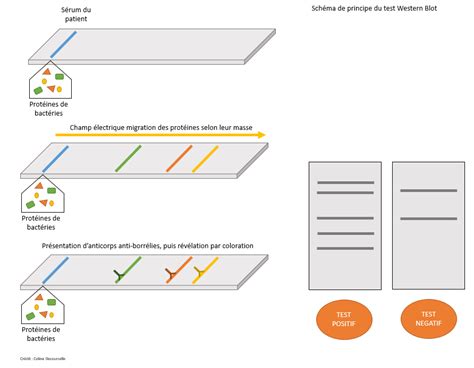 Elisa And Western Blot Test Wikiinriko