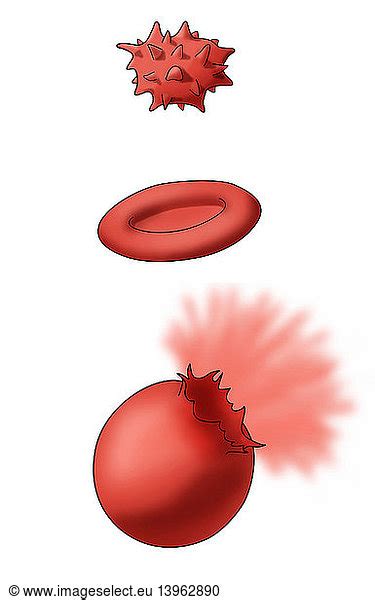 Osmosis In Red Blood Cells Osmosis In Red Blood Cells Illustration