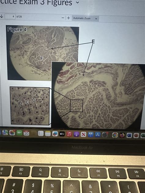 Peripheral Nerve Cross Section Diagram Quizlet